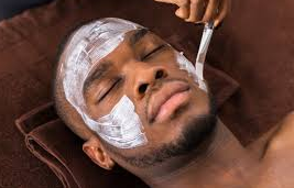 Chemical Peel